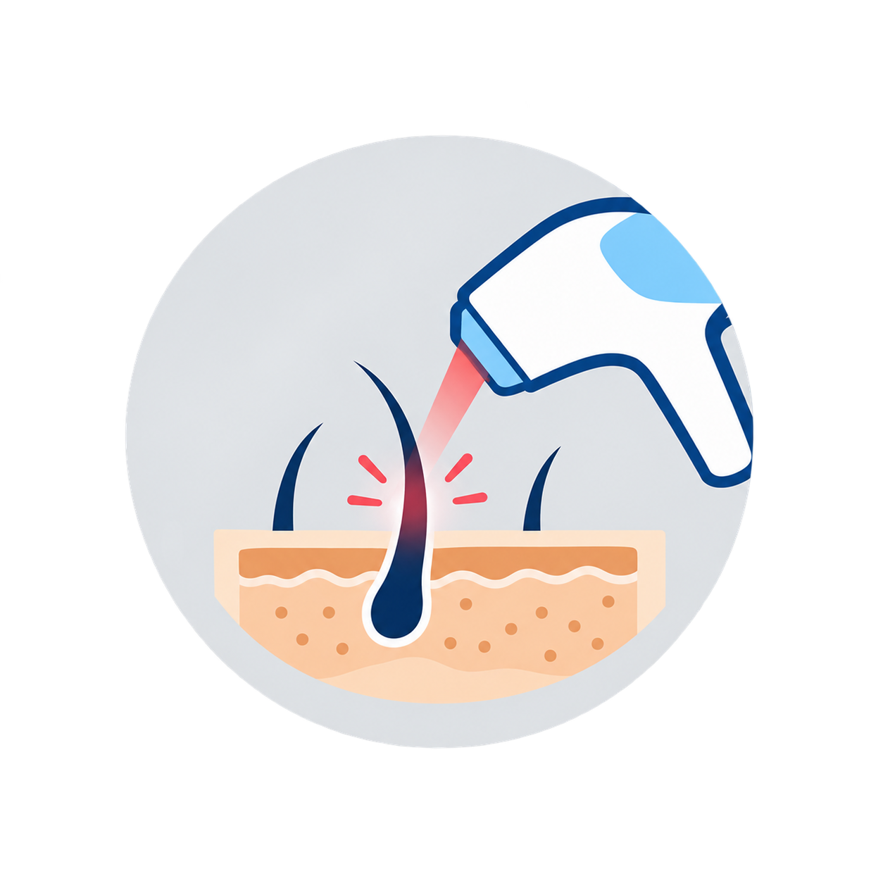 Laser Hair Removal